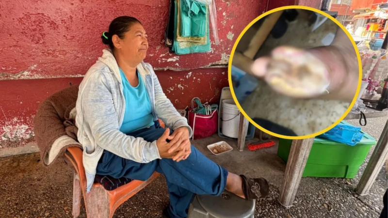 Mujer en situación vulnerable lucha por salvar su pie en Nanchital