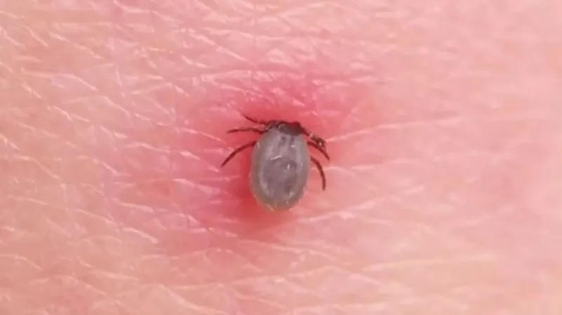 Plaga de garrapatas en Coatzacoalcos: ¡cuidado! estas son las 10 enfermedades que puedes contraer