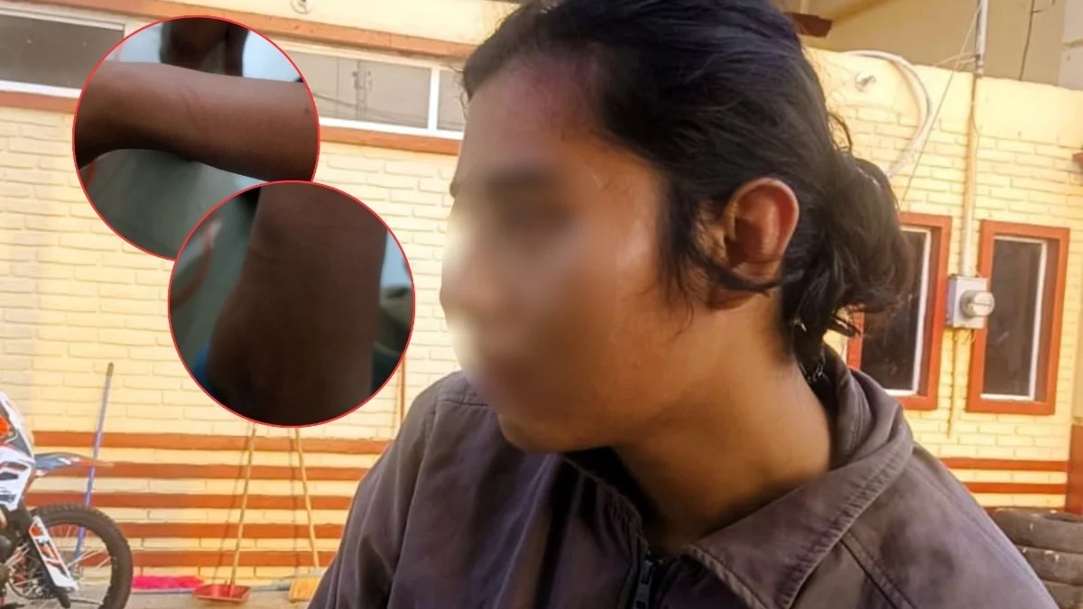 Joven vive un viacrucis; acusa a policías estatales de golpearlo y robarle en Oluta