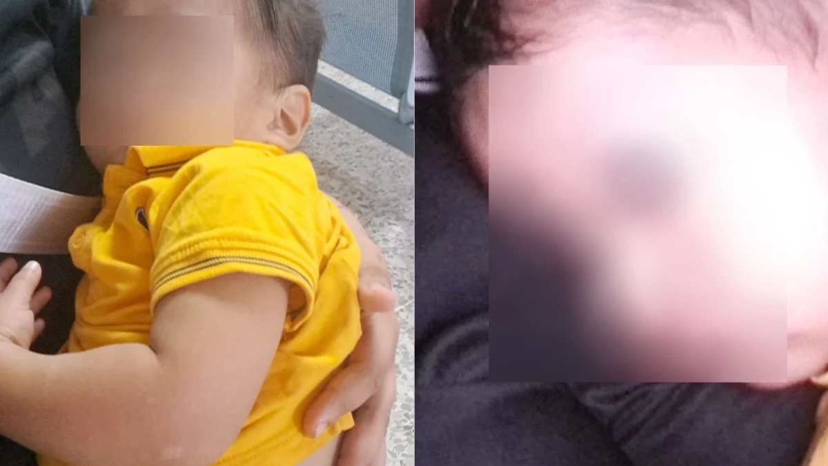 Jesús Karev lucha contra el síndrome nefrótico; familia de Nanchital pide apoyo