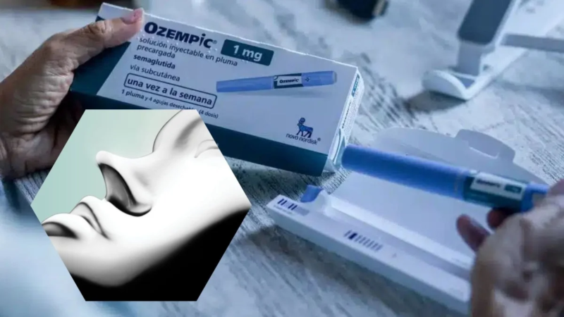 El Efecto Ozempic Dispara la Demanda de Tratamientos y Cirugías Estéticas