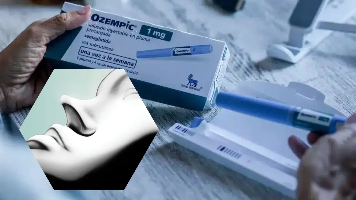 El Efecto Ozempic Dispara la Demanda de Tratamientos y Cirugías Estéticas